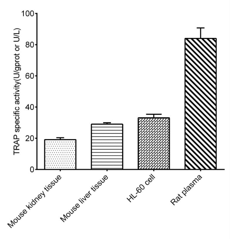TRACP/PAP/ACP5 Activity Assay Kit (Colorimetric)