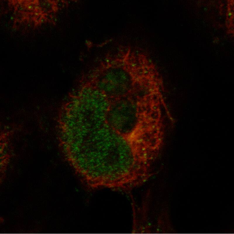 Ctip1 Antibody (CL13530) - BSA Free Immunocytochemistry/ Immunofluorescence: Ctip1 Antibody (CL13530) [NBP3-24563]