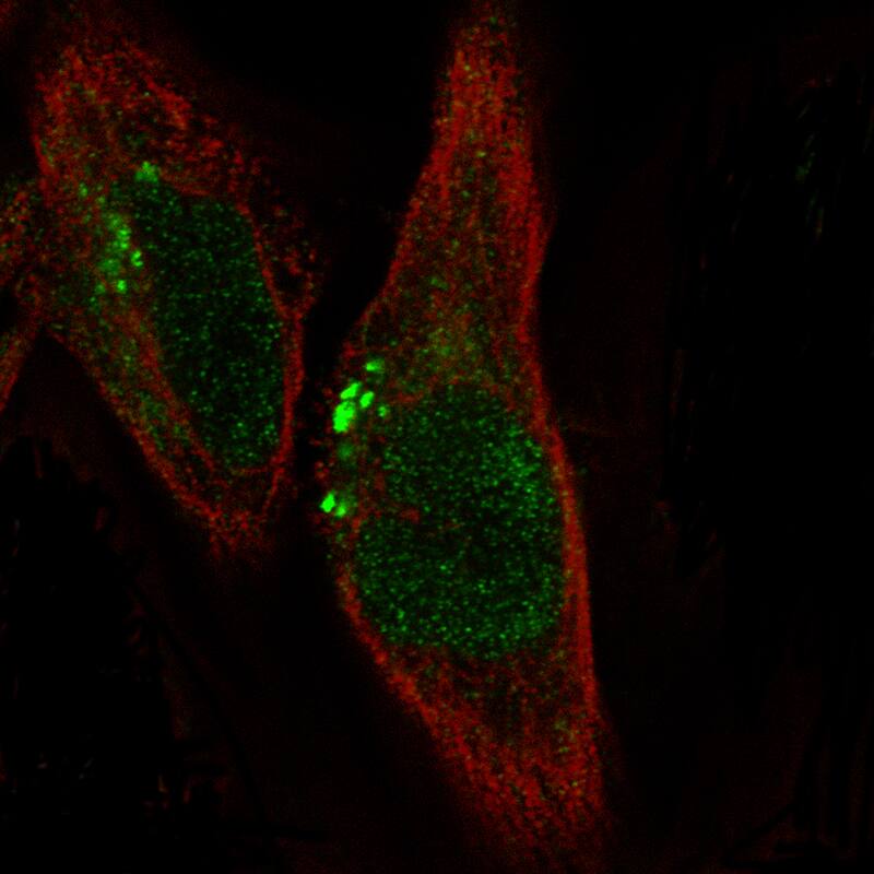 ADAM10 Antibody (CL13814) - BSA Free Immunocytochemistry/ Immunofluorescence: ADAM10 Antibody (CL13814) [NBP3-24579]