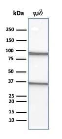 CD20 Antibody (L26)