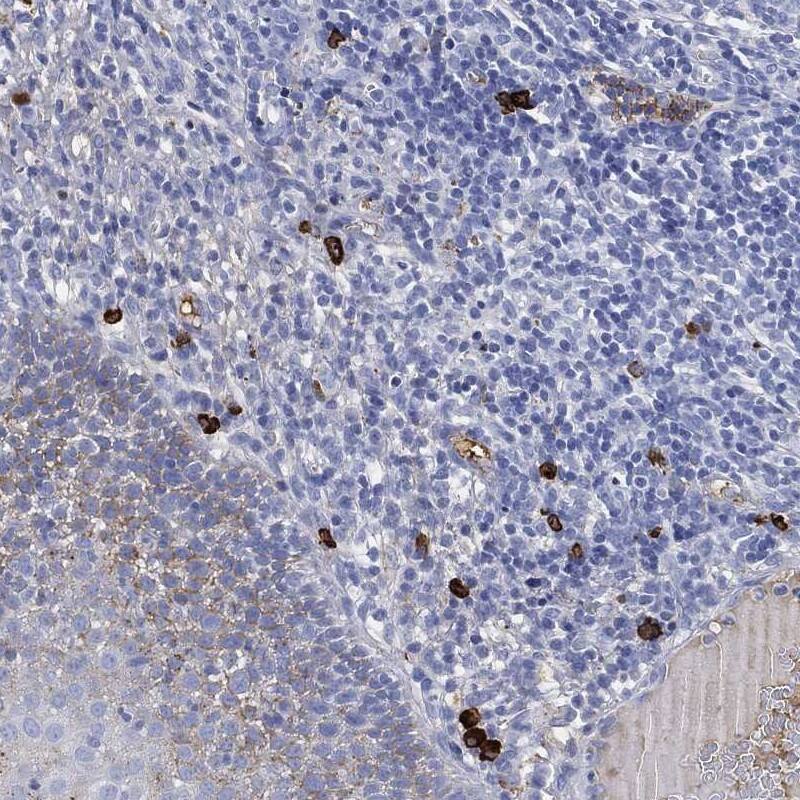 IGLV6-57 Antibody Immunohistochemistry-Paraffin: IGLV6-57 Antibody [NBP3-24694]