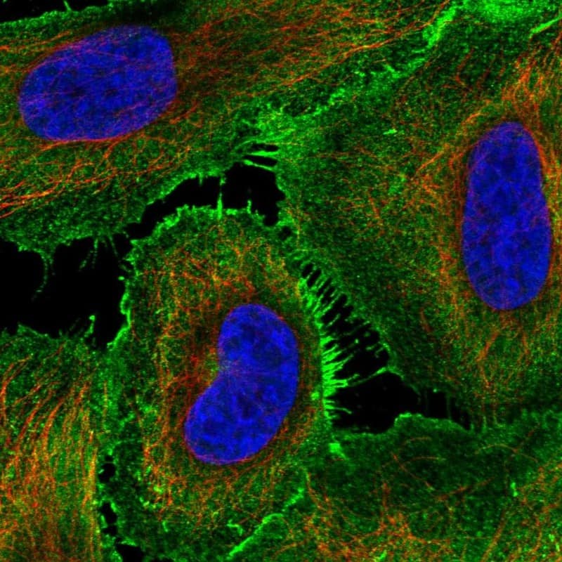 AJM1 Antibody Immunocytochemistry/Immunofluorescence: AJM1 Antibody [NBP3-24697]