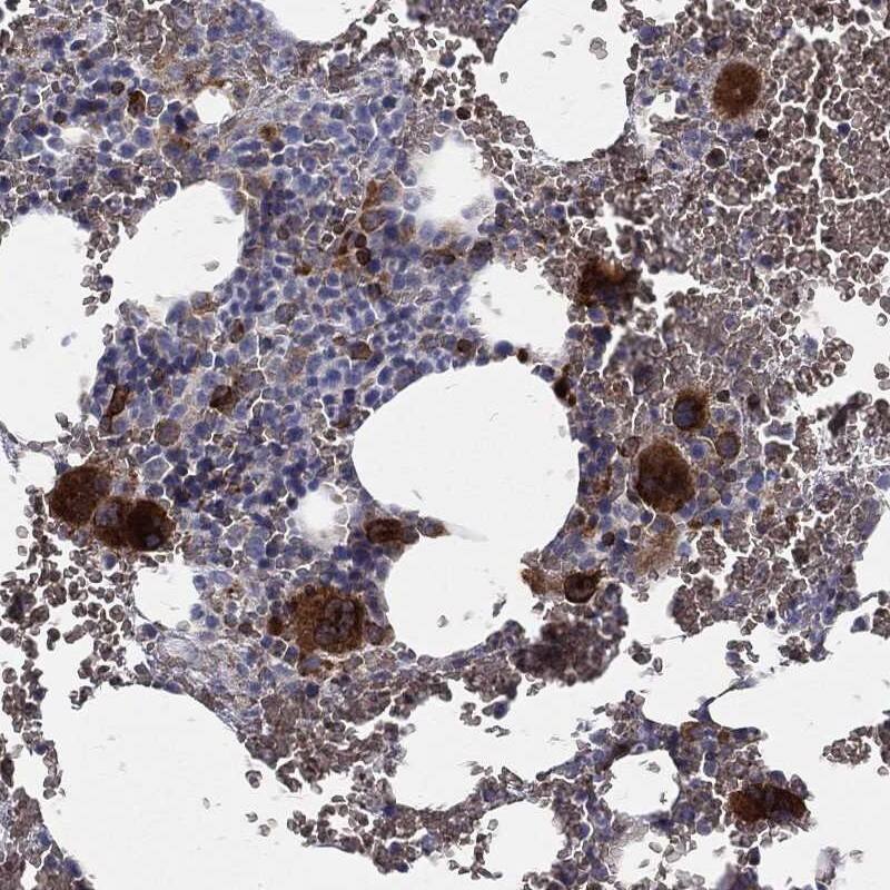 Cathepsin W Antibody Immunohistochemistry-Paraffin: Cathepsin W Antibody [NBP3-24704]