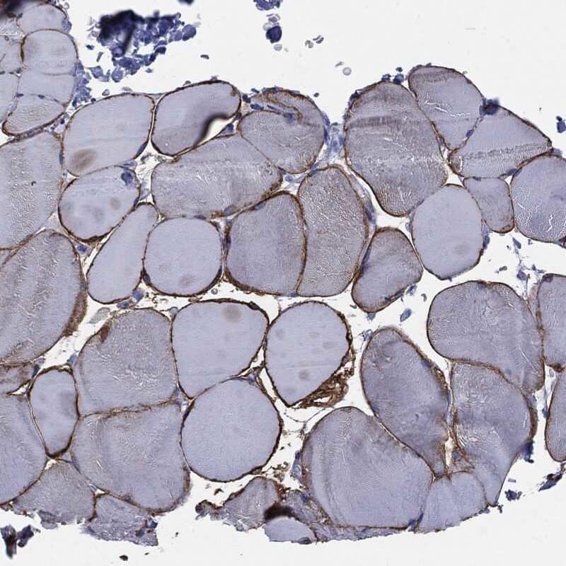 Caveolin-3 Antibody Immunohistochemistry-Paraffin: Caveolin-3 Antibody [NBP3-24705]