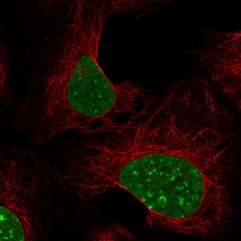 CBX1 Antibody Immunocytochemistry/Immunofluorescence: CBX1 Antibody [NBP3-24706]