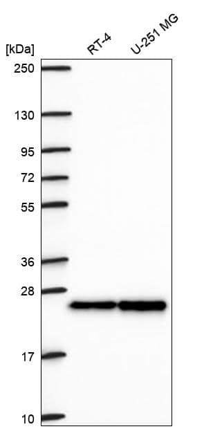 CBX1 Antibody Western Blot: CBX1 Antibody [NBP3-24706]