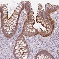 Ccd1/DIXDC1 Antibody Immunohistochemistry-Paraffin: Ccd1/DIXDC1 Antibody [NBP3-24708]