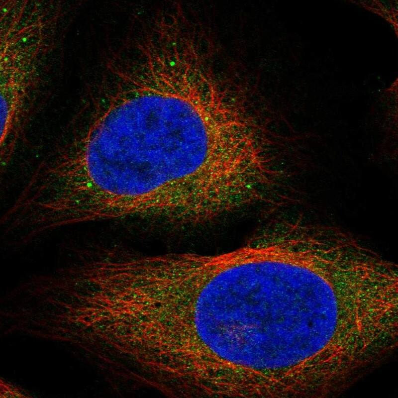 CCDC134 Antibody Immunocytochemistry/Immunofluorescence: CCDC134 Antibody [NBP3-24710]