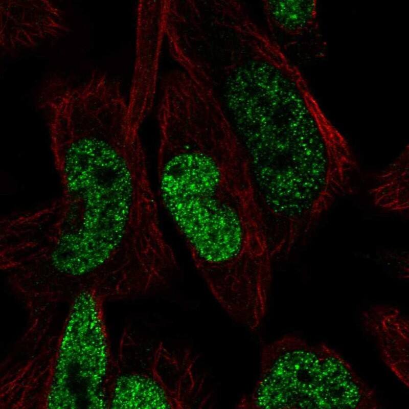 FGGY carbohydrate kinase domain containing Antibody Immunocytochemistry/Immunofluorescence: FGGY carbohydrate kinase domain containing Antibody [NBP3-24712]