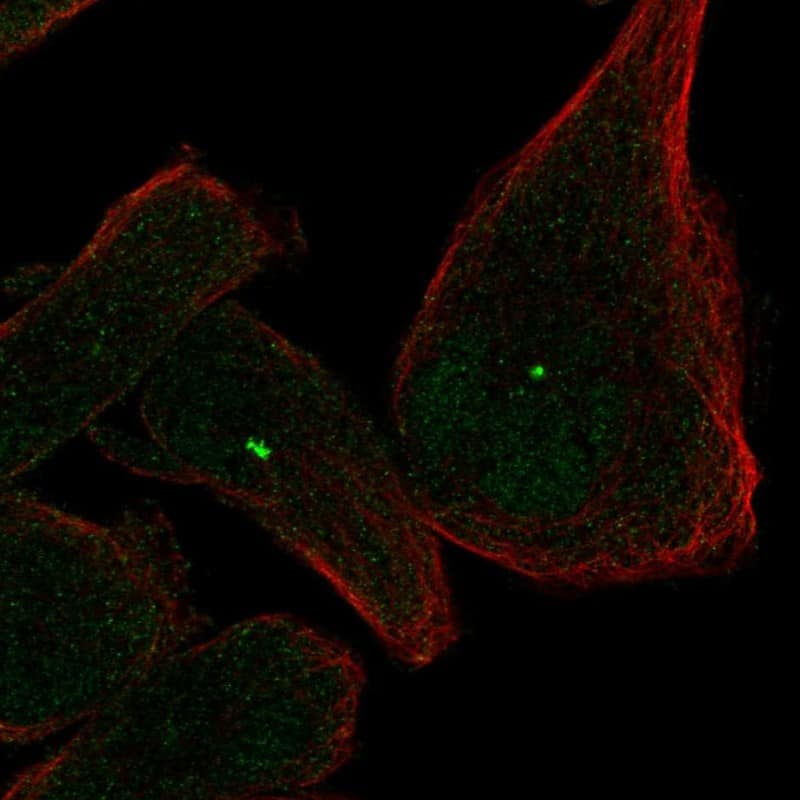 CCDC46 Antibody Immunocytochemistry/Immunofluorescence: CCDC46 Antibody [NBP3-24714]