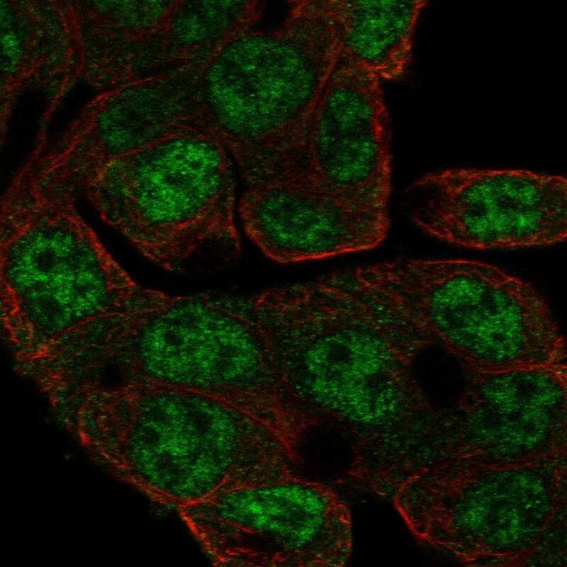 CCDC83 Antibody Immunocytochemistry/Immunofluorescence: CCDC83 Antibody [NBP3-24715]