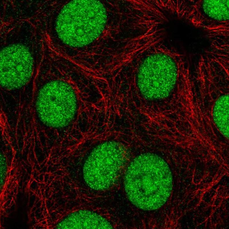 CCNY Antibody Immunocytochemistry/Immunofluorescence: CCNY Antibody [NBP3-24719]