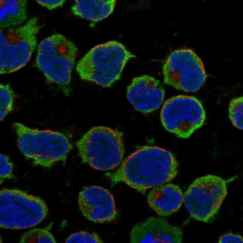 CCR9 Antibody Immunocytochemistry/Immunofluorescence: CCR9 Antibody [NBP3-24721]