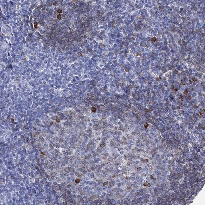 CD79A Antibody Immunohistochemistry-Paraffin: CD79A Antibody [NBP3-24725]