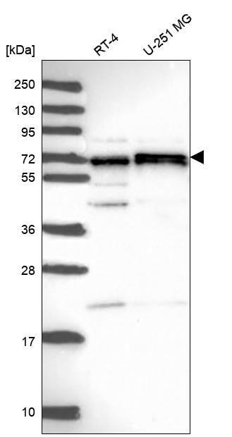 CDK5RAP1 Antibody Western Blot: CDK5RAP1 Antibody [NBP3-24728]