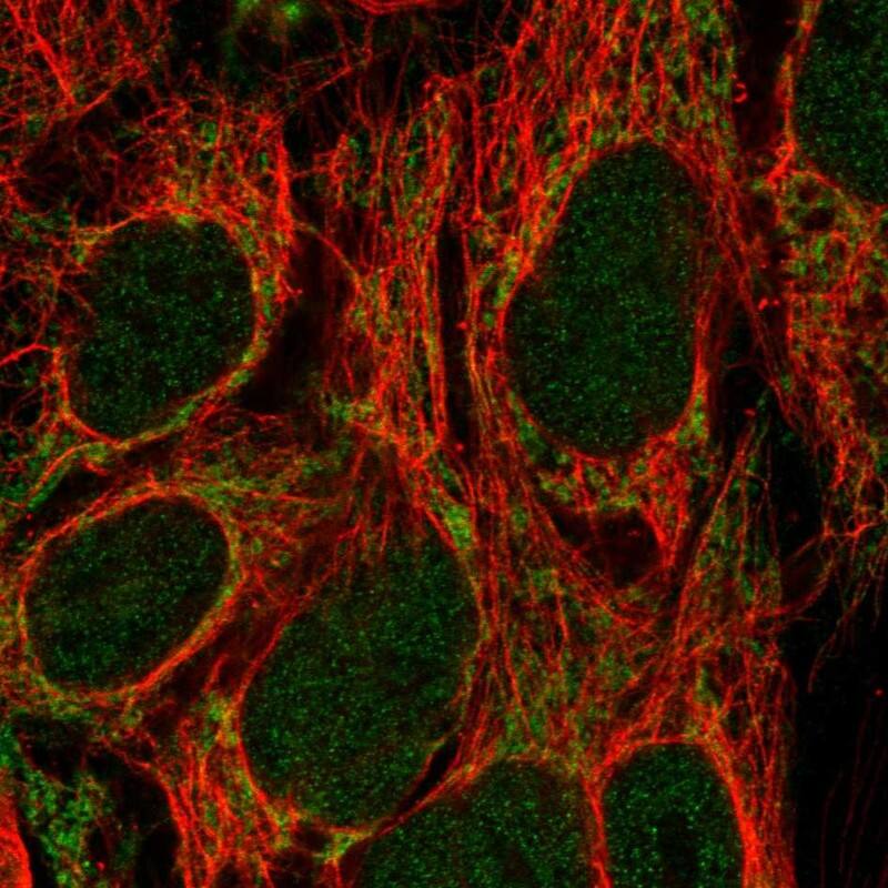 CDK5RAP1 Antibody Immunocytochemistry/Immunofluorescence: CDK5RAP1 Antibody [NBP3-24728]