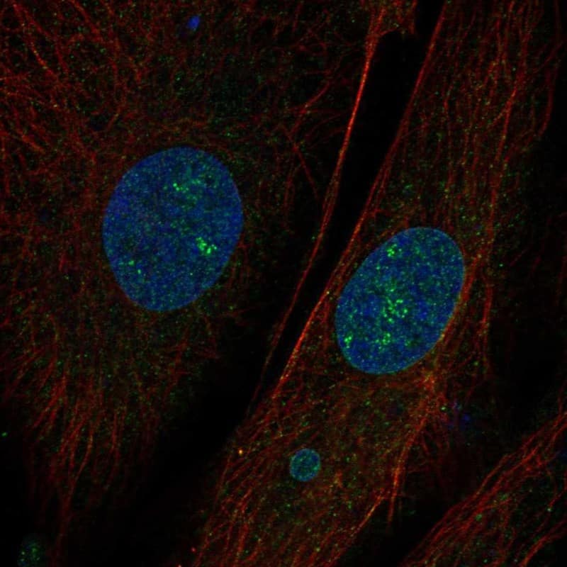 CEMIP/KIAA1199 Antibody Immunocytochemistry/Immunofluorescence: CEMIP/KIAA1199 Antibody [NBP3-24730]