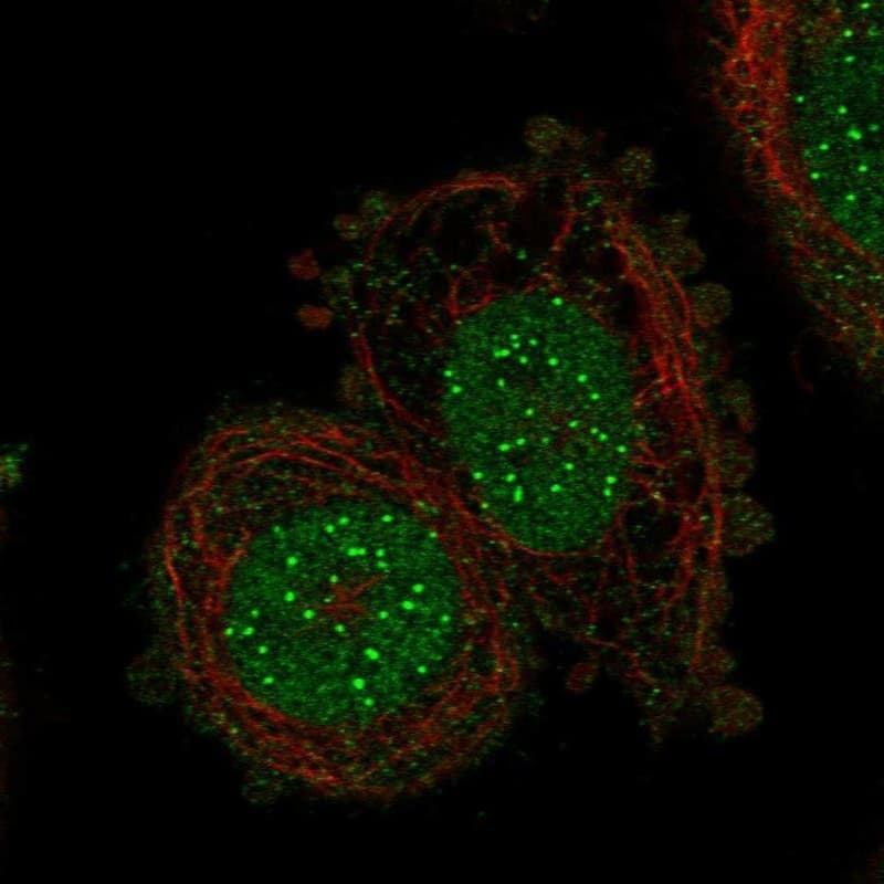 CENPI Antibody Immunocytochemistry/Immunofluorescence: CENPI Antibody [NBP3-24732]