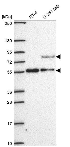 CENPI Antibody Western Blot: CENPI Antibody [NBP3-24732]