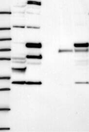 CEP63 Antibody Western Blot: CEP63 Antibody [NBP3-24736]