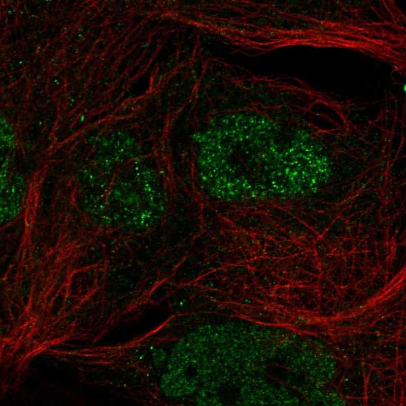 cGAS Antibody Immunocytochemistry/Immunofluorescence: cGAS Antibody [NBP3-24738]