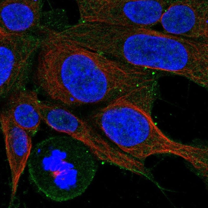 Cholecystokinin-B R/CCKBR Antibody Immunocytochemistry/Immunofluorescence: Cholecystokinin-B R/CCKBR Antibody [NBP3-24739]