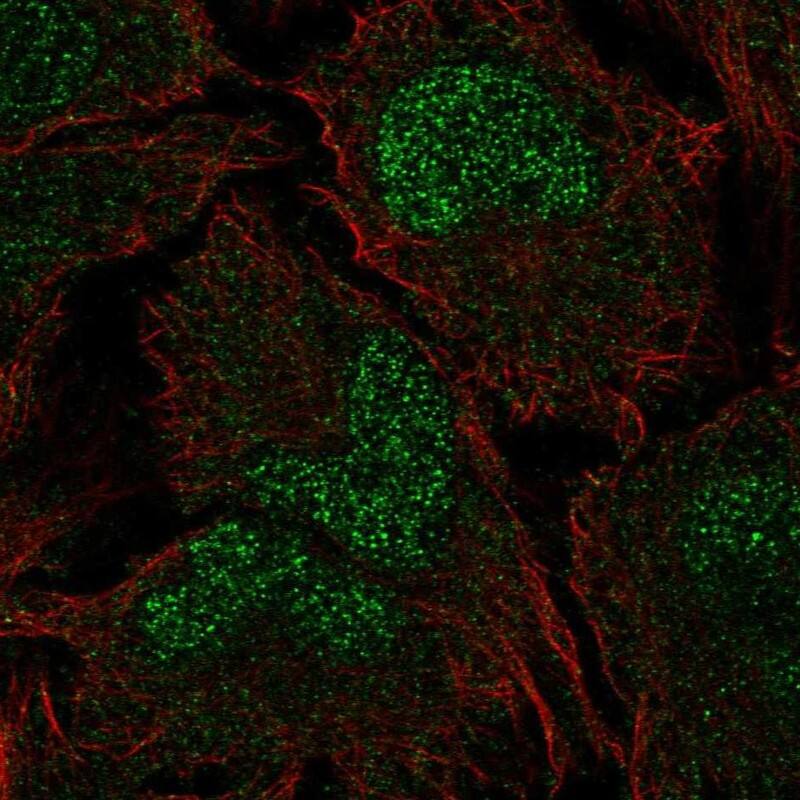 Chp2 Antibody Immunocytochemistry/Immunofluorescence: Chp2 Antibody [NBP3-24740]