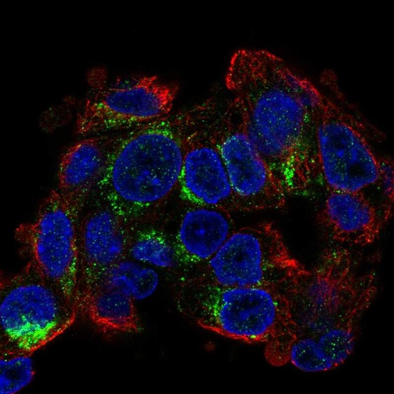 CIDEB Antibody Immunocytochemistry/Immunofluorescence: CIDEB Antibody [NBP3-24741]