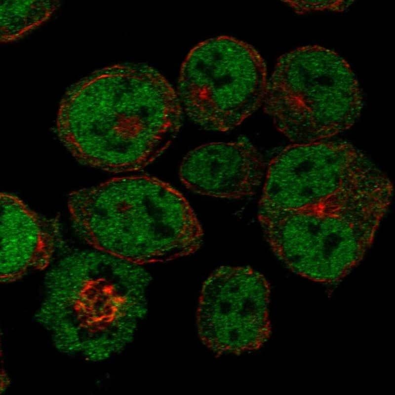 Cited-2 Antibody Immunocytochemistry/Immunofluorescence: Cited-2 Antibody [NBP3-24742]