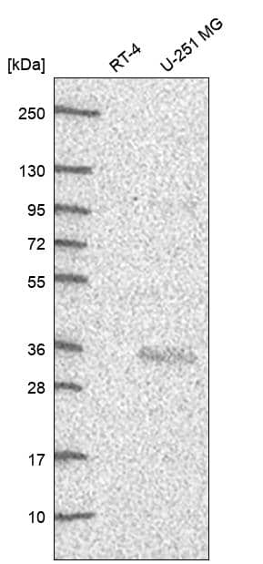 Cited-2 Antibody Western Blot: Cited-2 Antibody [NBP3-24743]