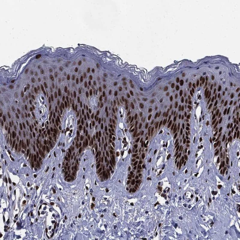 c-jun Antibody Immunohistochemistry-Paraffin: c-jun Antibody [NBP3-24744]