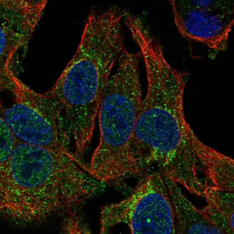 Claudin-20 Antibody Immunocytochemistry/Immunofluorescence: Claudin-20 Antibody [NBP3-24746]