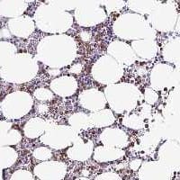 CLEC-2/CLEC-1B Antibody Immunohistochemistry-Paraffin: CLEC-2/CLEC-1B Antibody [NBP3-24748]