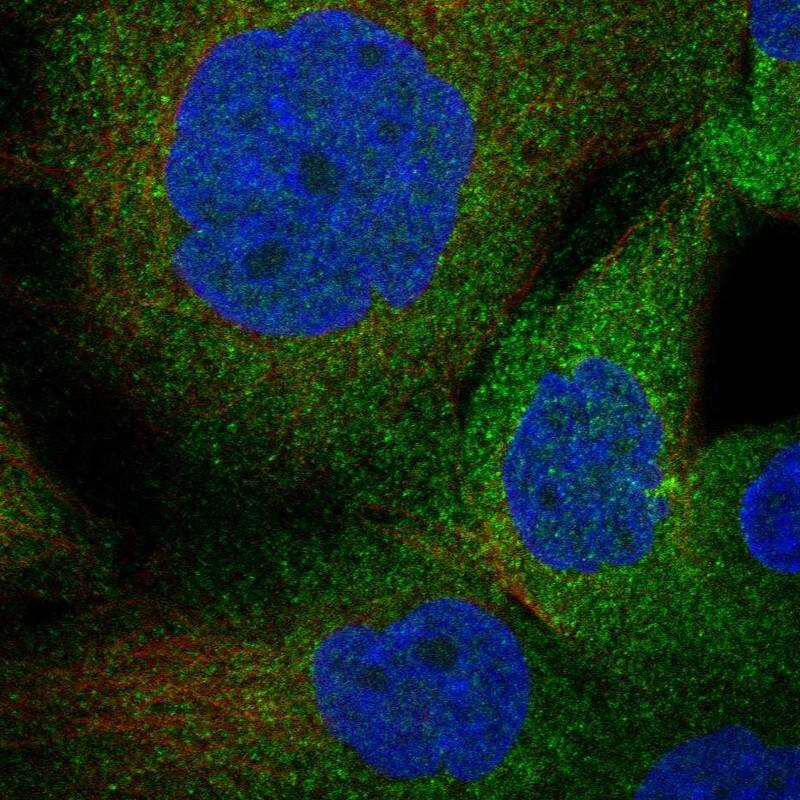 Clusterin/APOJ Antibody Immunocytochemistry/Immunofluorescence: Clusterin/APOJ Antibody [NBP3-24749]