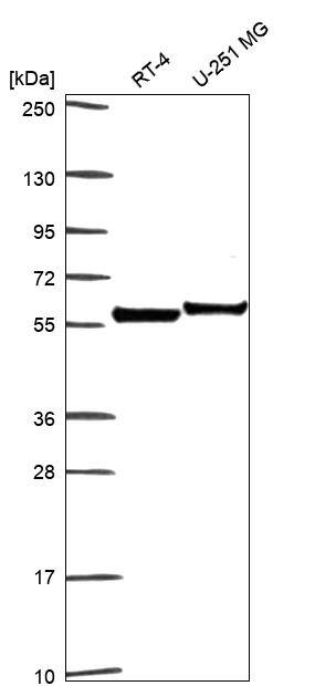 Clusterin/APOJ Antibody Western Blot: Clusterin/APOJ Antibody [NBP3-24749]