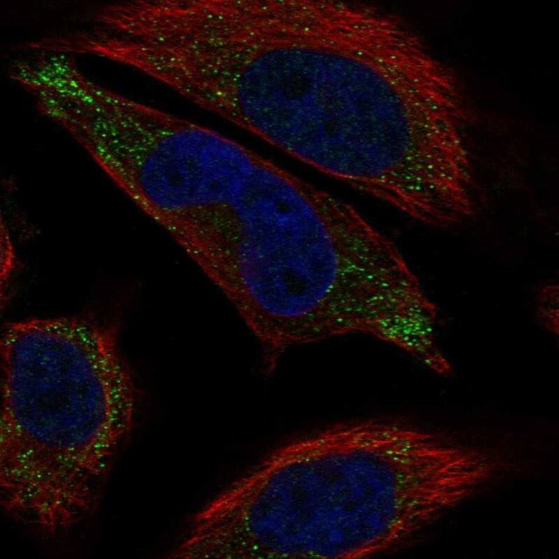 LHFPL5 Antibody Immunocytochemistry/Immunofluorescence: LHFPL5 Antibody [NBP3-24750]