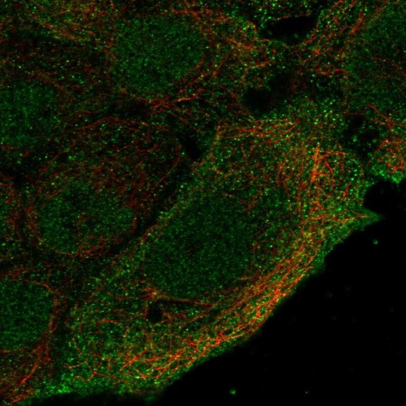 CNGA4 Antibody Immunocytochemistry/Immunofluorescence: CNGA4 Antibody [NBP3-24751]