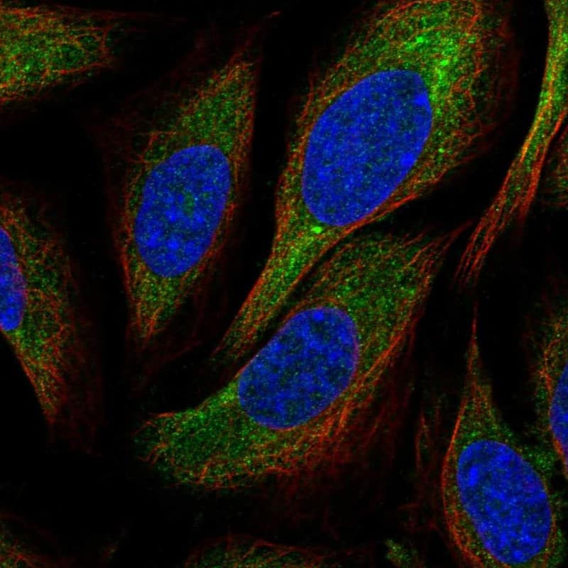 CNOT1 Antibody Immunocytochemistry/Immunofluorescence: CNOT1 Antibody [NBP3-24752]