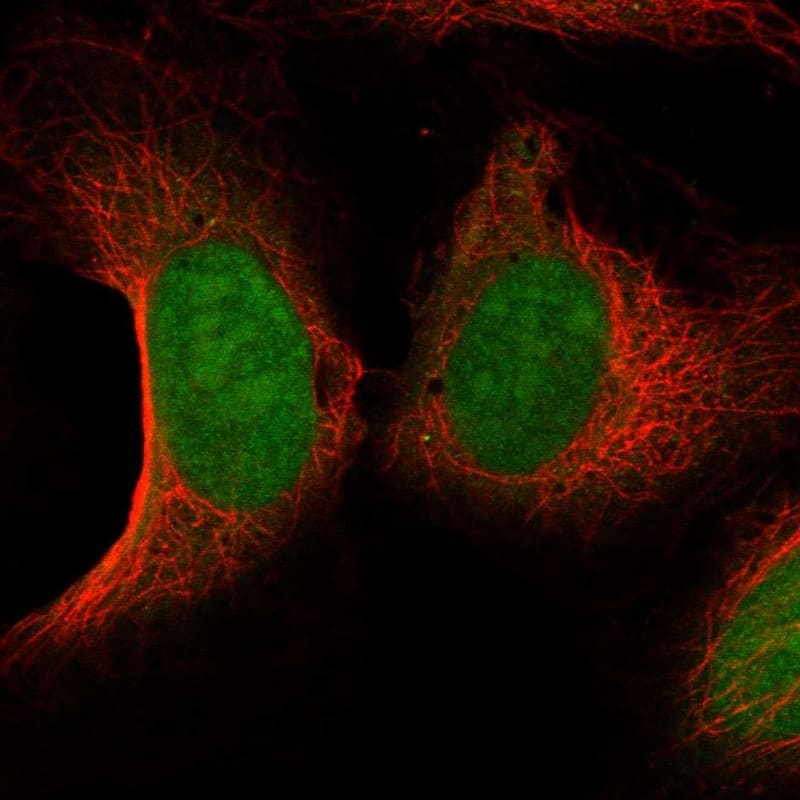 CNTD Antibody Immunocytochemistry/Immunofluorescence: CNTD Antibody [NBP3-24753]