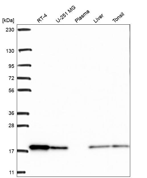 Cofilin Antibody Western Blot: Cofilin Antibody [NBP3-24754]