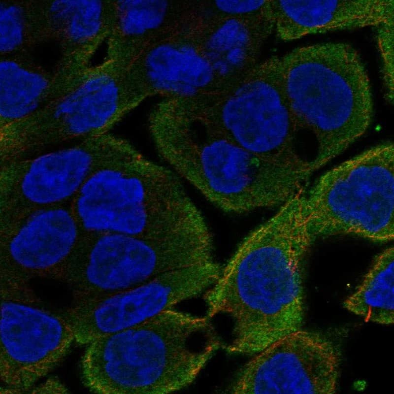 Cofilin Antibody Immunocytochemistry/Immunofluorescence: Cofilin Antibody [NBP3-24754]