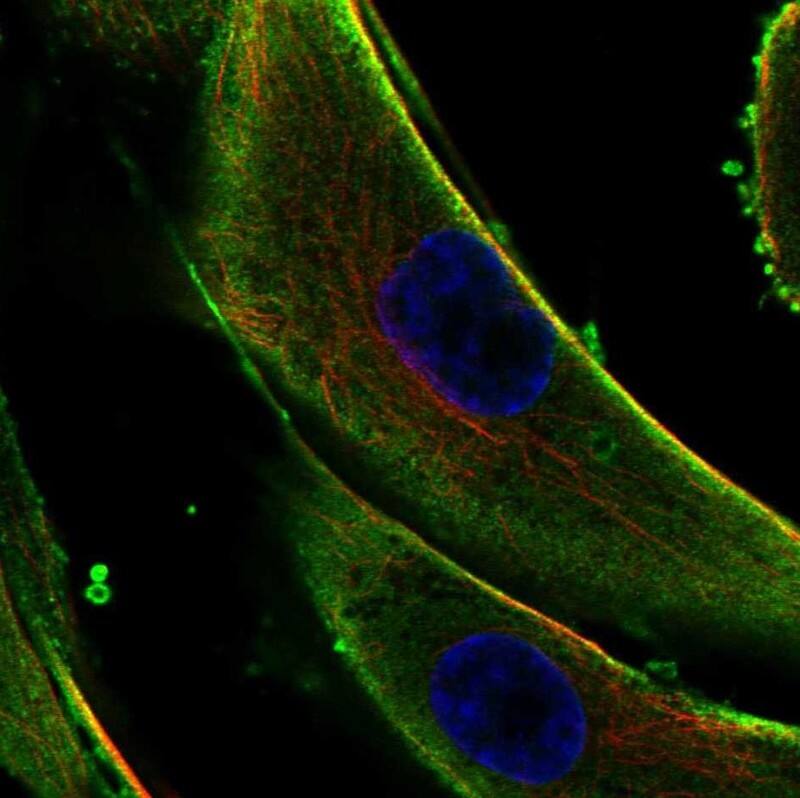 Collagen V alpha 3 Antibody Immunocytochemistry/Immunofluorescence: Collagen V alpha 3 Antibody [NBP3-24758]