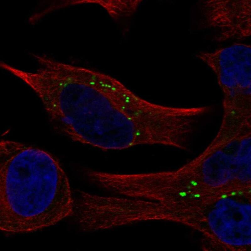 COMMD2 Antibody Immunocytochemistry/Immunofluorescence: COMMD2 Antibody [NBP3-24759]