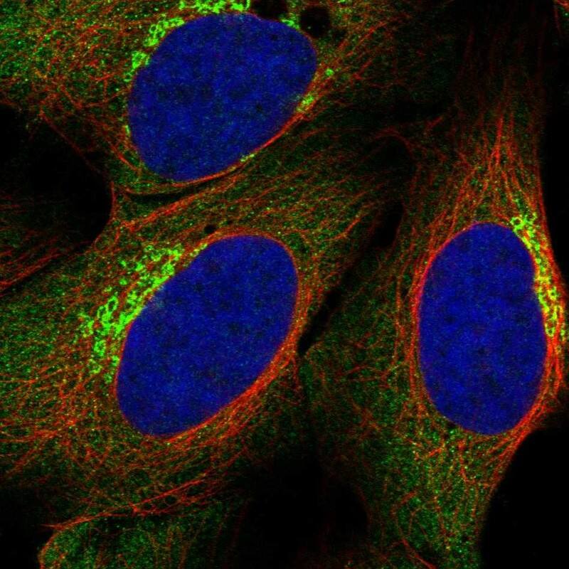 MMP-11 Antibody Immunocytochemistry/Immunofluorescence: MMP-11 Antibody [NBP3-24762]