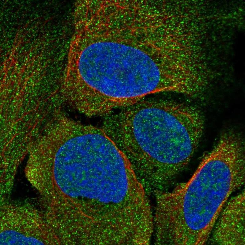 CRHR2/CRF2 Antibody Immunocytochemistry/Immunofluorescence: CRHR2/CRF2 Antibody [NBP3-24764]