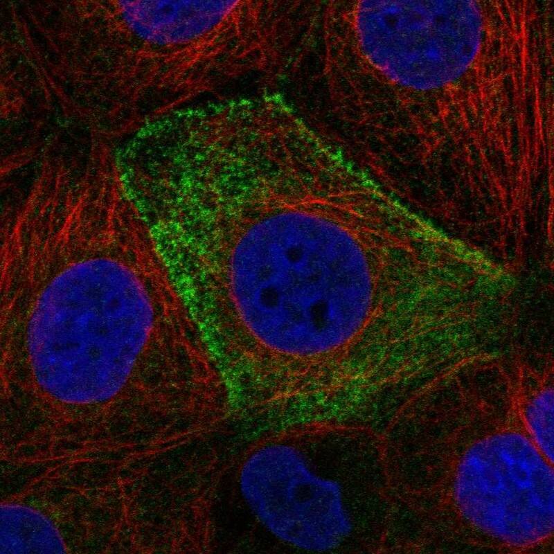 CSAD Antibody Immunocytochemistry/Immunofluorescence: CSAD Antibody [NBP3-24766]