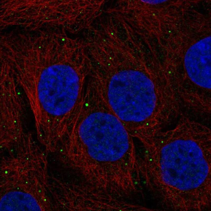 CTNS Antibody Immunocytochemistry/Immunofluorescence: CTNS Antibody [NBP3-24768]