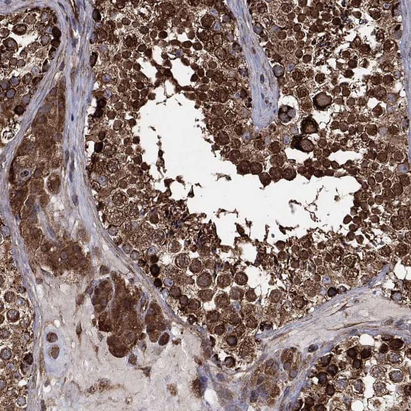 CYLD Antibody Immunohistochemistry-Paraffin: CYLD Antibody [NBP3-24772]