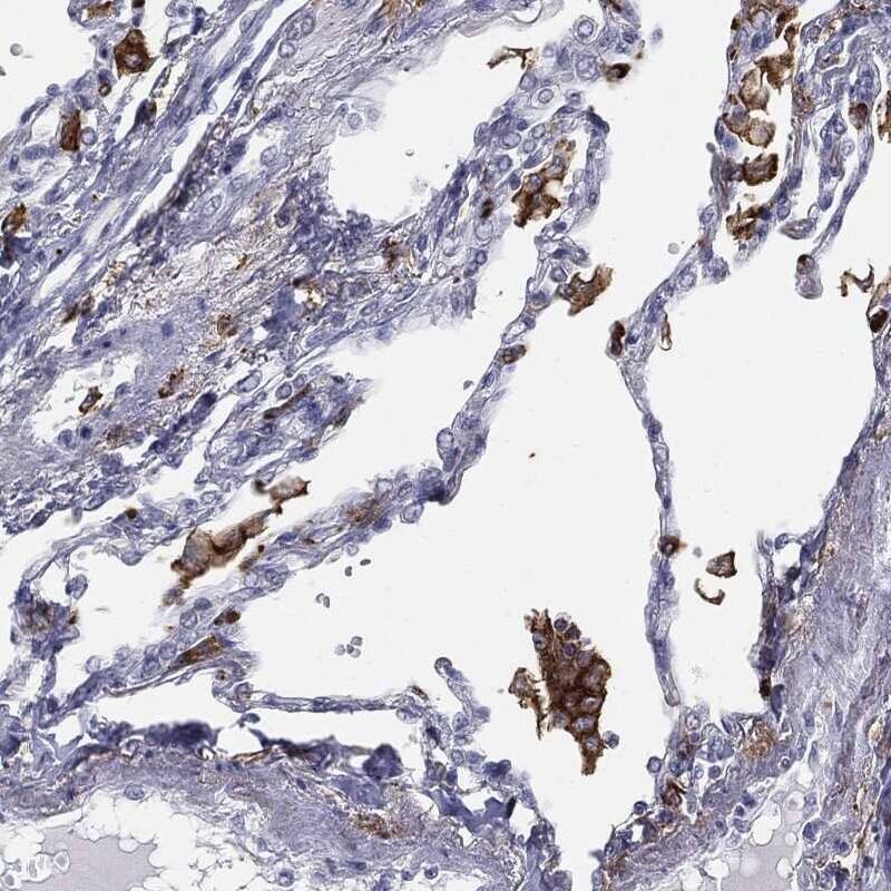 Cytochrome b245 alpha Antibody Immunohistochemistry-Paraffin: Cytochrome b245 alpha Antibody [NBP3-24774]