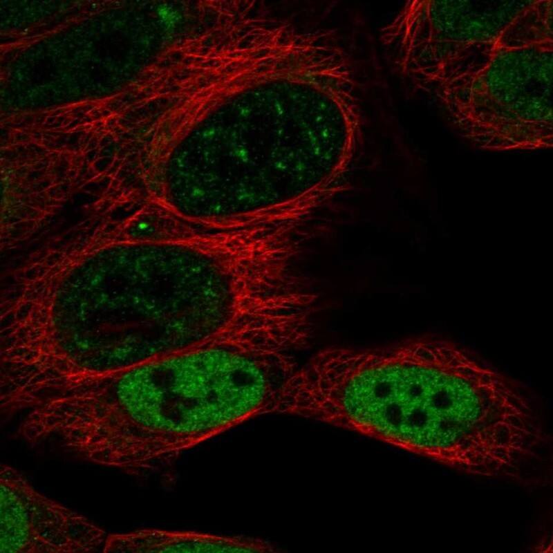 DACH1 Antibody Immunocytochemistry/Immunofluorescence: DACH1 Antibody [NBP3-24776]